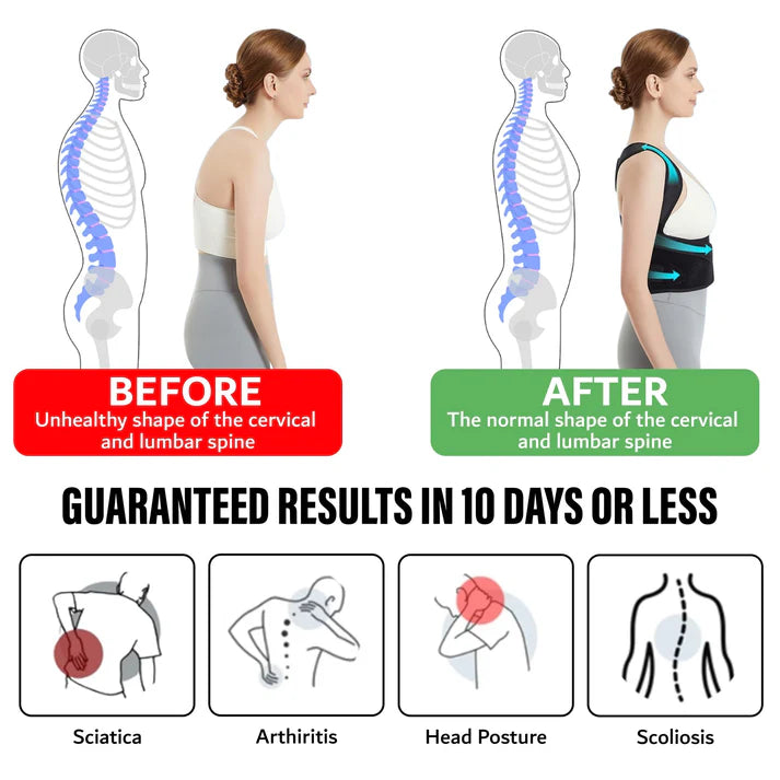 Adjustable Posture Corrector Belt